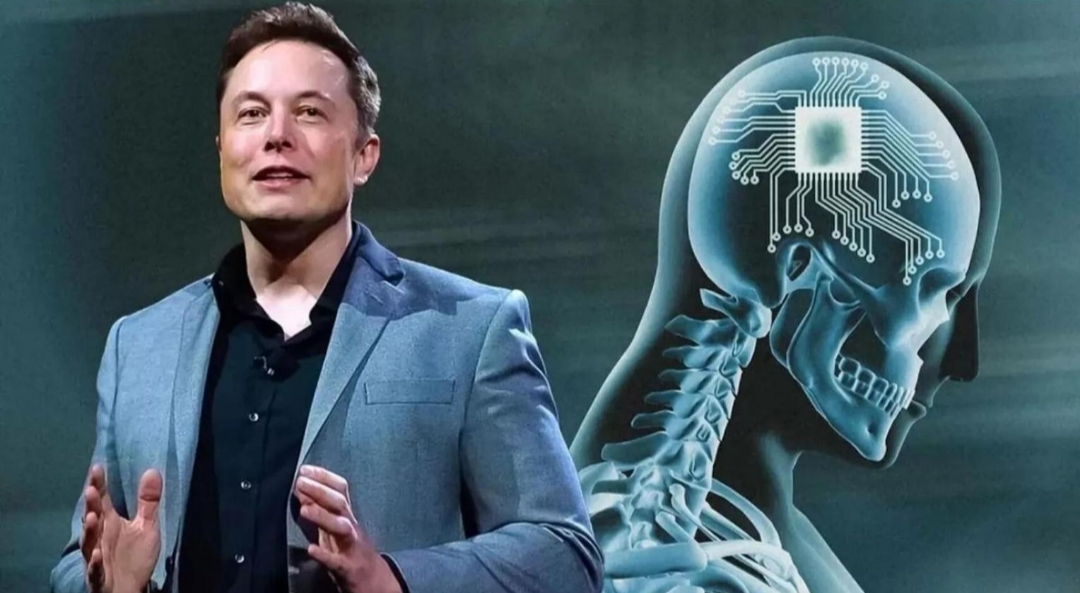 El chip de Neuralink avanza en humanos y promete revolucionar la medicina y la conexión cerebro–computadora